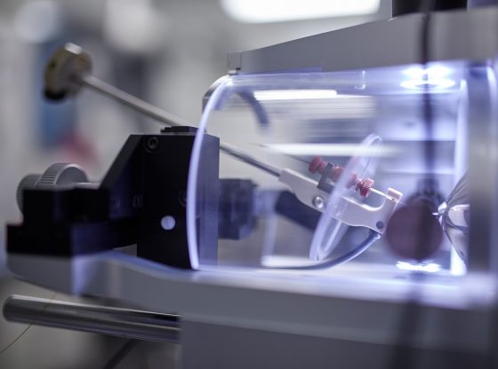 Mithilfe von Massenspektrometrie haben Forschende Biomarker-Profile identifiziert, die den Schweregrad einer COVID-19-Erkrankung beschreiben und zukünftig für die Vorhersage des Krankheitsverlaufs genutzt werden könnten (Foto: Charité/Arne Sattler)